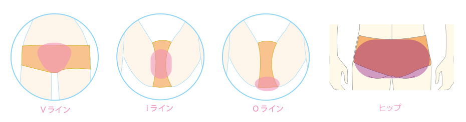 HIFU（ハイフ）施術箇所